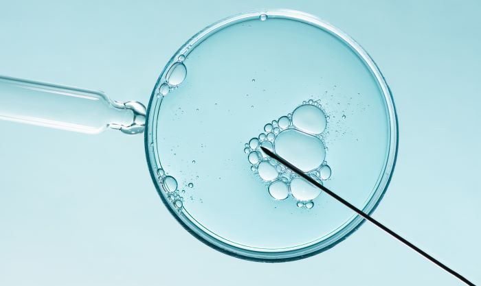 IVF zorgkosten vergoeding